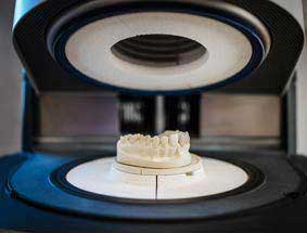 Gebissabdruck Gebissabdruck